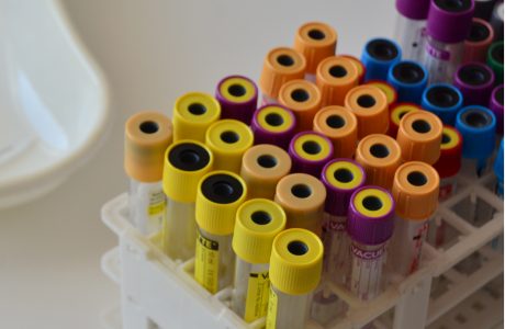 Забор биоматериала